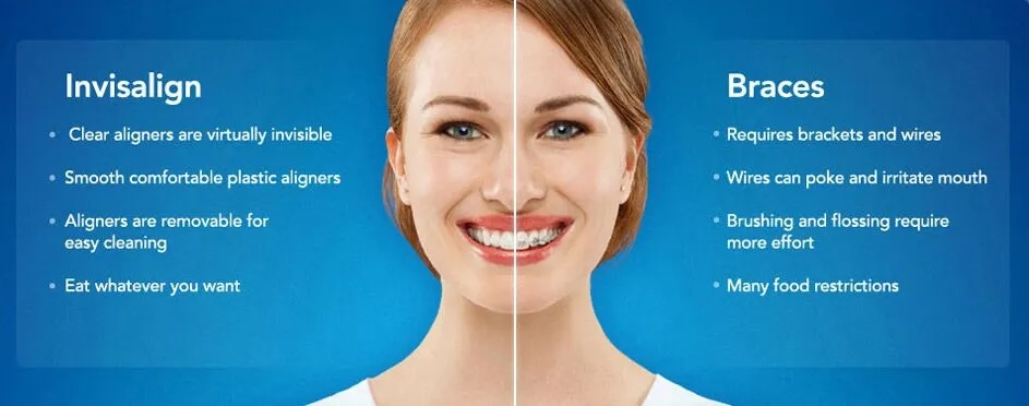 invisalign2